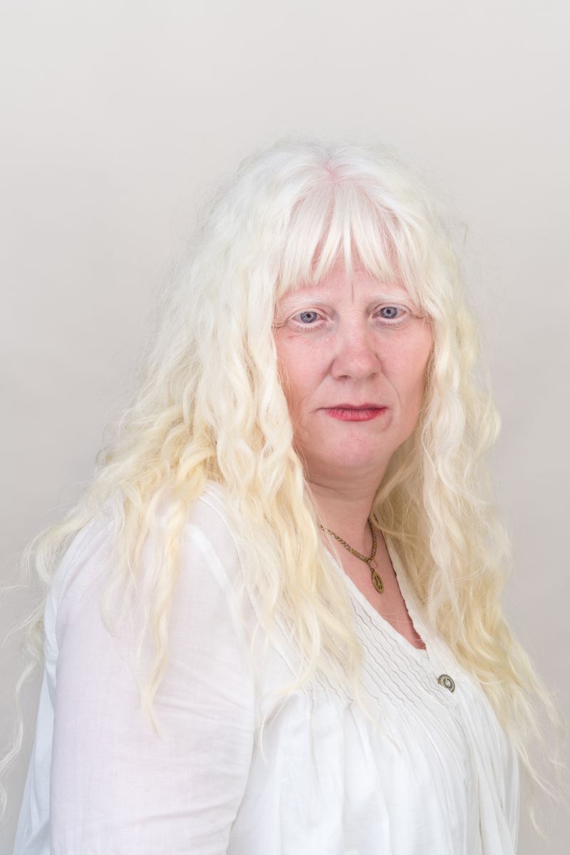 © Jorge Monaco - Image from the ALBINOS, BEING DIFFERENT photography project