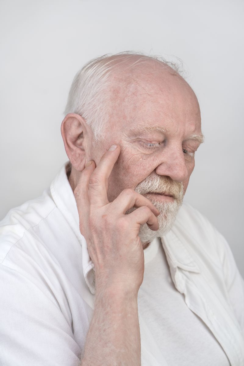 © Jorge Monaco - Image from the ALBINOS, BEING DIFFERENT photography project