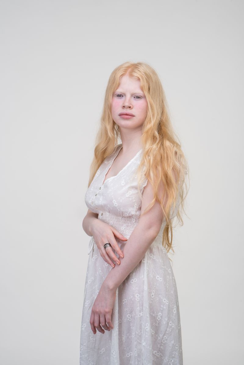 © Jorge Monaco - Image from the ALBINOS, BEING DIFFERENT photography project
