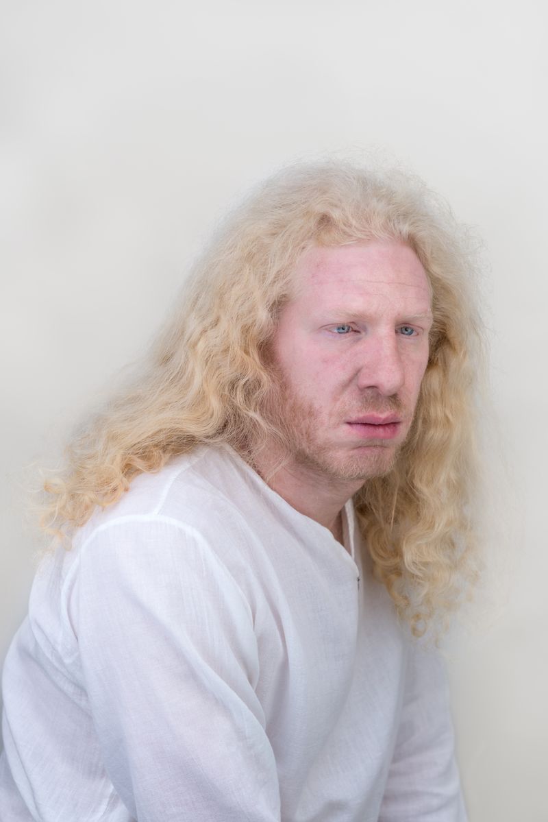 © Jorge Monaco - Image from the ALBINOS, BEING DIFFERENT photography project