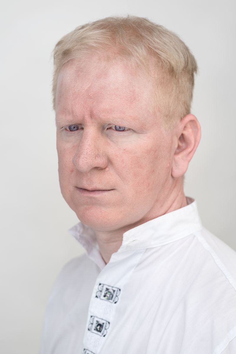 © Jorge Monaco - Image from the ALBINOS, BEING DIFFERENT photography project