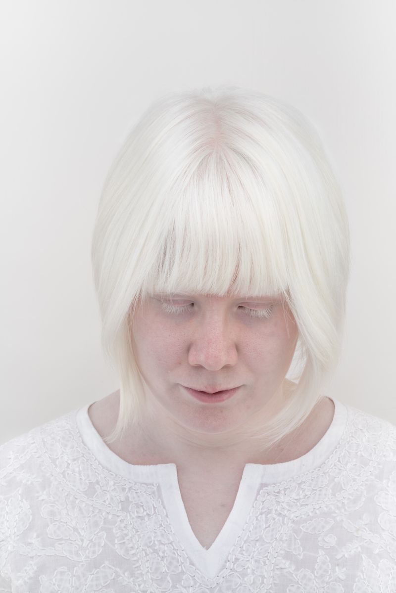 © Jorge Monaco - Image from the ALBINOS, BEING DIFFERENT photography project