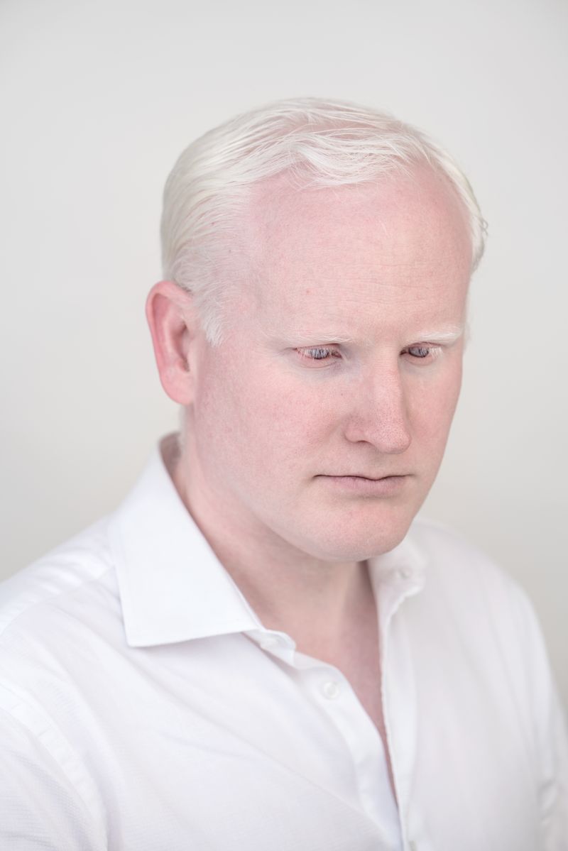 © Jorge Monaco - Image from the ALBINOS, BEING DIFFERENT photography project