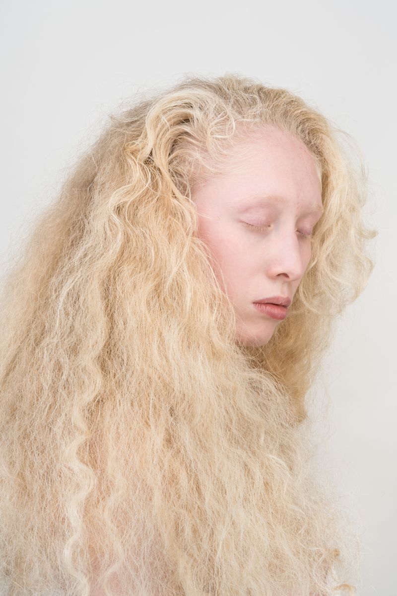 © Jorge Monaco - Image from the ALBINOS, BEING DIFFERENT photography project