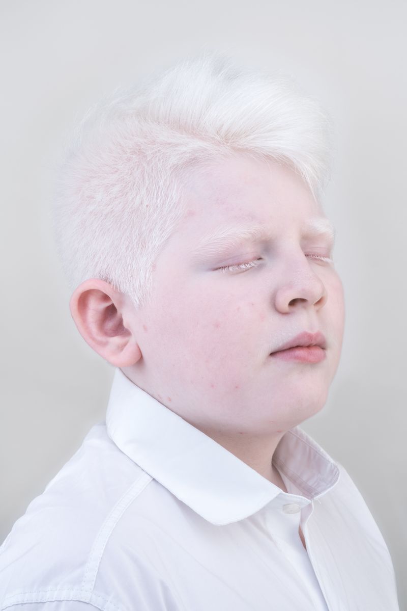 © Jorge Monaco - Image from the ALBINOS, BEING DIFFERENT photography project