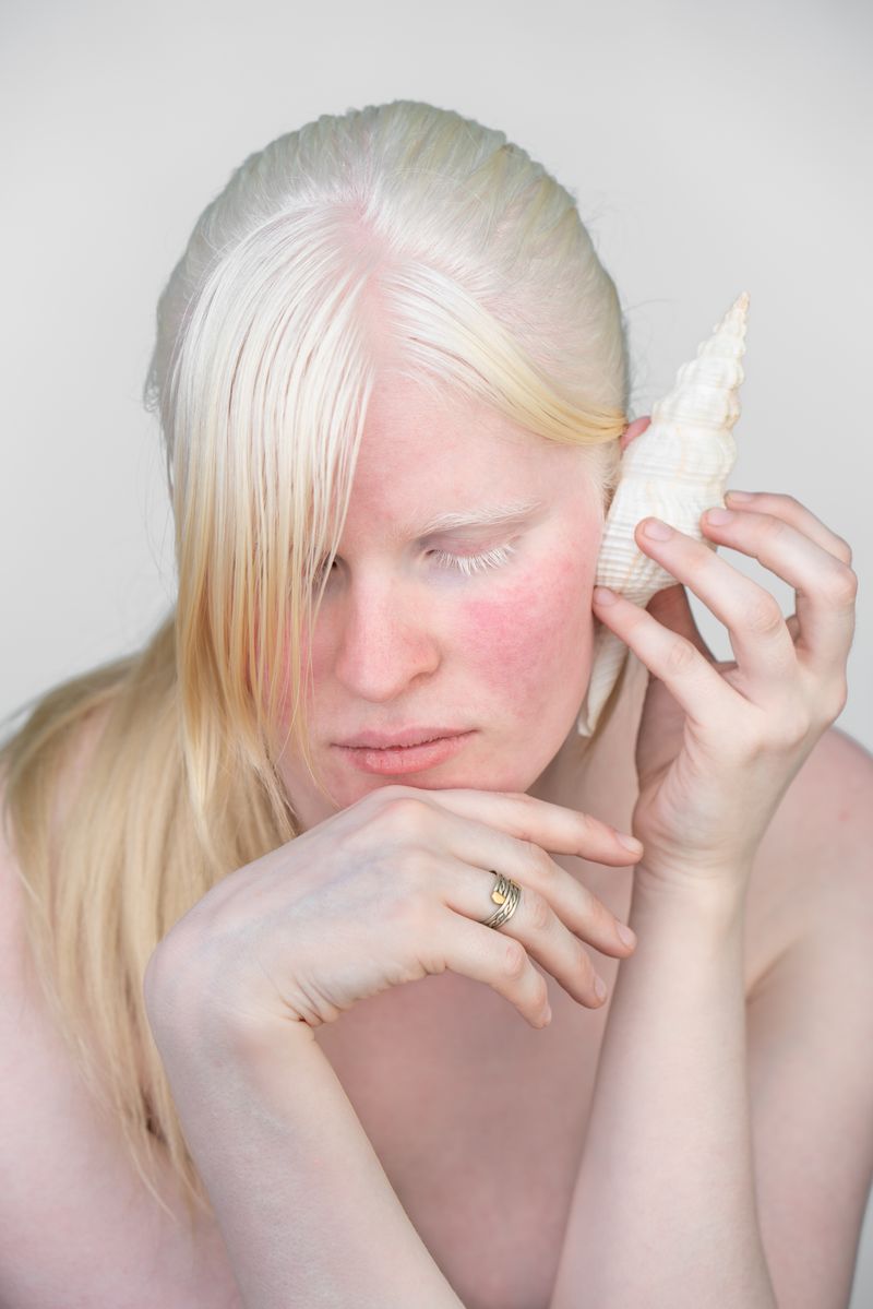 © Jorge Monaco - Image from the ALBINOS, BEING DIFFERENT photography project