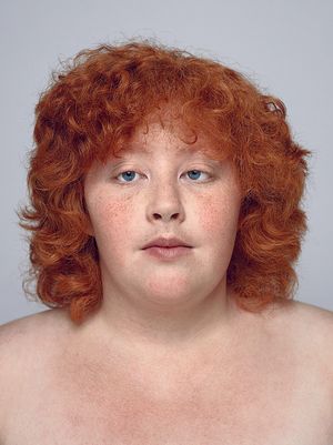 The Beautiful Gene