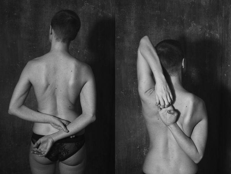 © Natasha Gor - Portrait of Polina after fracture