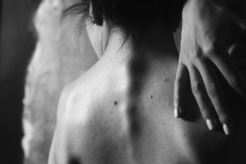 © Natasha Gor - Nastya. Vertebrae