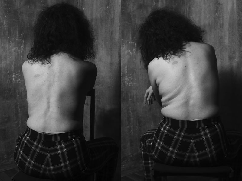 © Natasha Gor - Portrait of Aykui. She has a curvature of the spine due to playing the violin