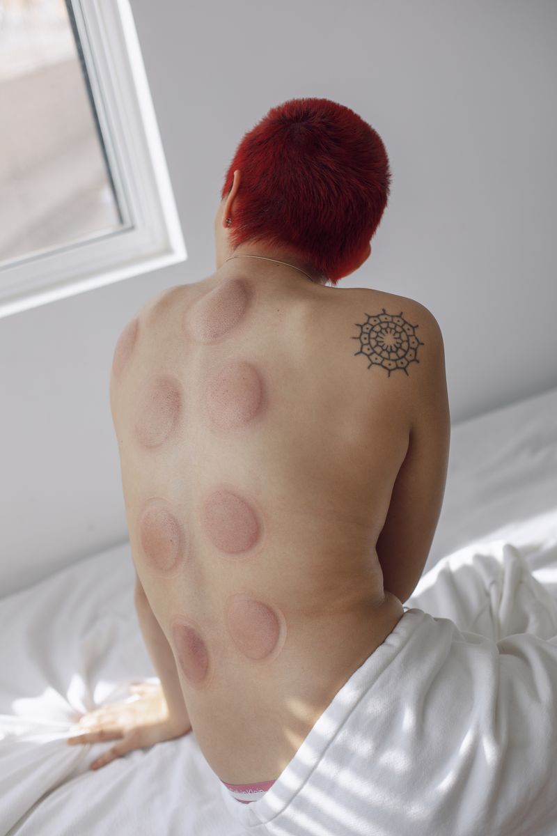 © Leafy Yun Ye - Sofya has a cupping treatment at home, Los Angeles, 2025.