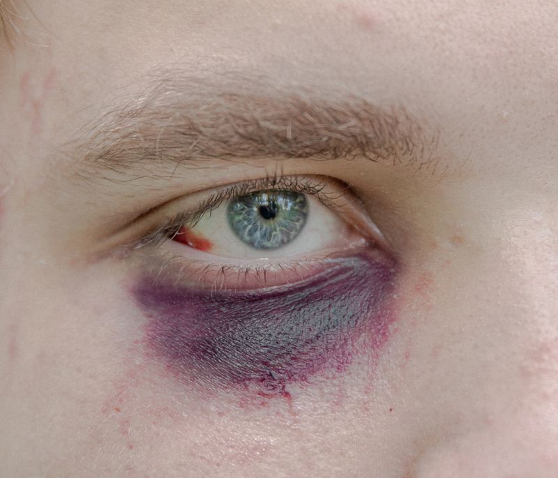 Traces of Imposed Violence in Belarusian Society