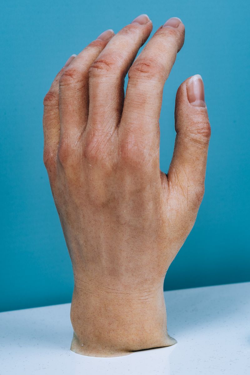 Photographer Aristidis Schnelzer Explores the Advancements of Medical Technologies