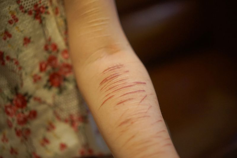 Visualising the Effects of Child Abuse in Japan