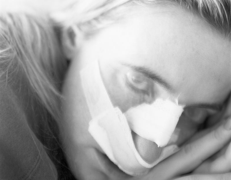 © Mateo Ruiz Gonzalez - Broken Nose, 2023