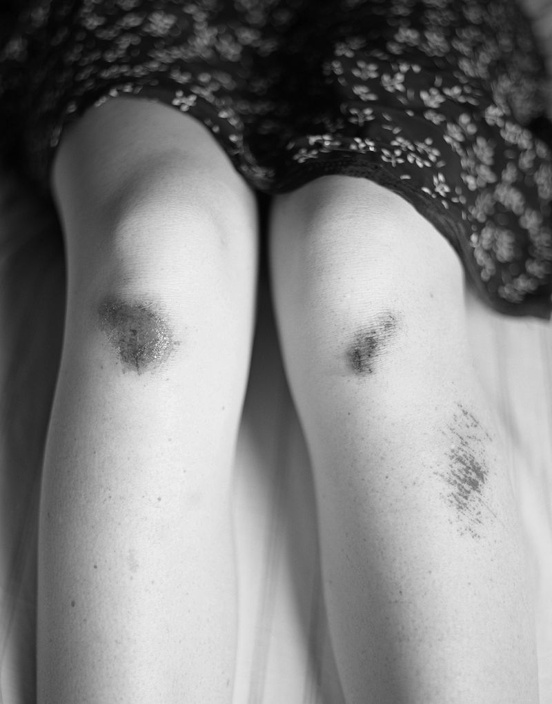 © Mateo Ruiz Gonzalez - Scrapped Knees, 2022