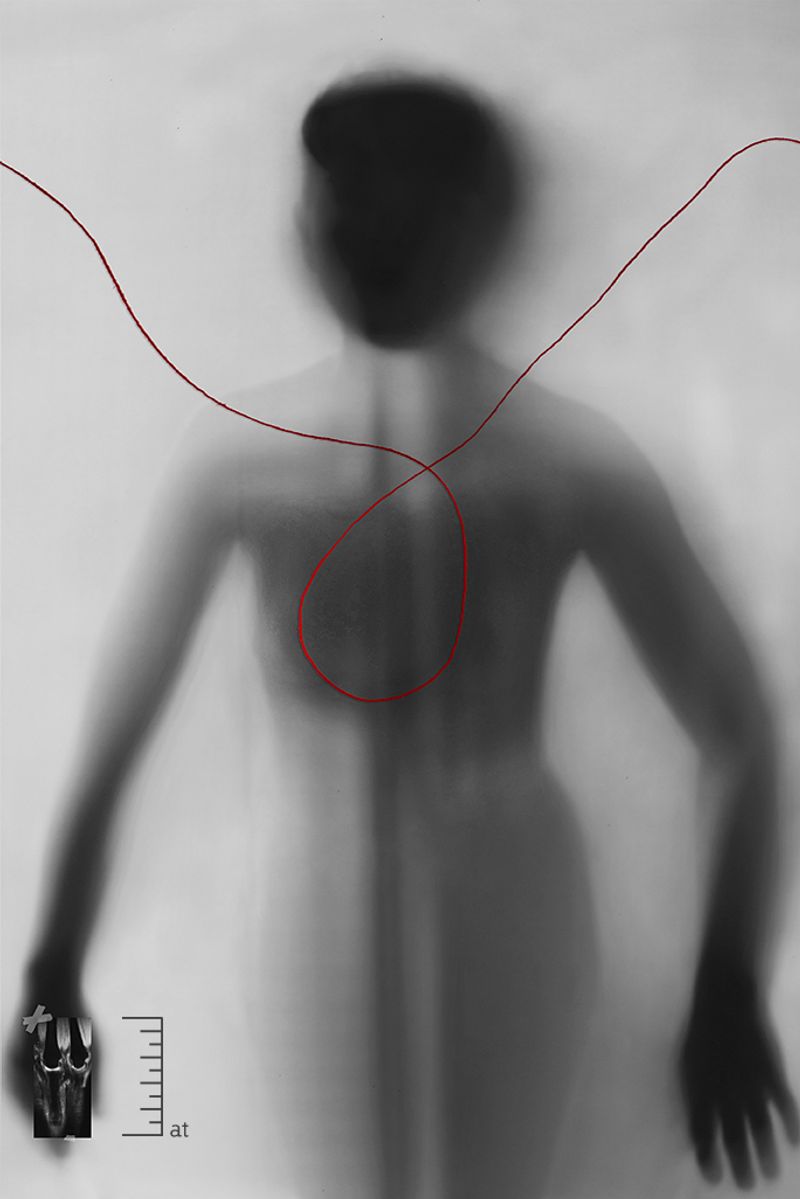 © Janine Bello - Image from the ANEMIA photography project