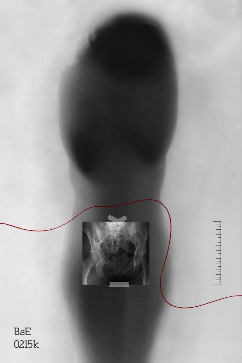 © Janine Bello - Image from the ANEMIA photography project