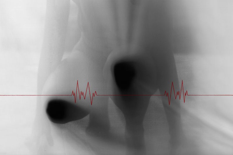 © Janine Bello - Image from the ANEMIA photography project