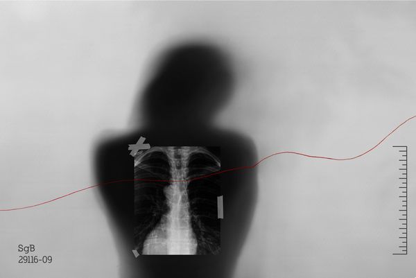 © Janine Bello - Image from the ANEMIA photography project