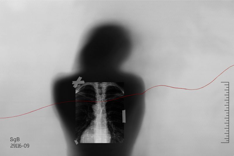 © Janine Bello - Image from the ANEMIA photography project