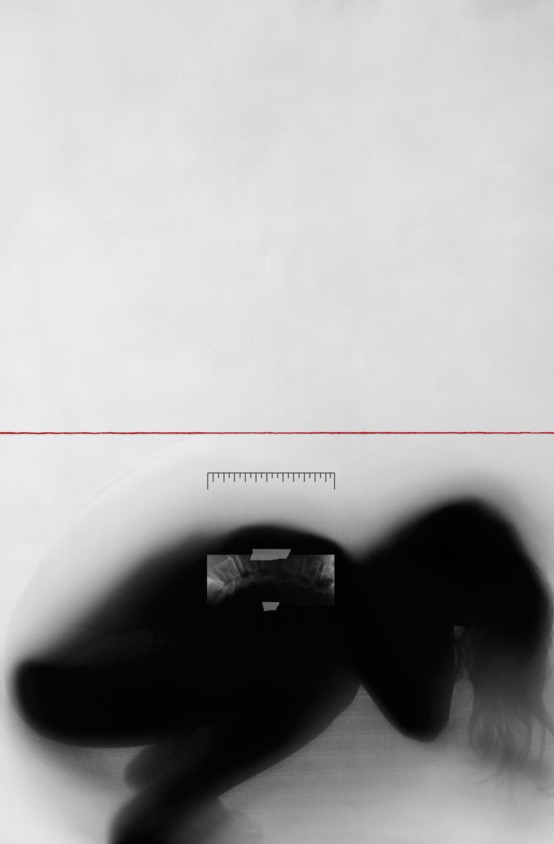 © Janine Bello - Image from the ANEMIA photography project