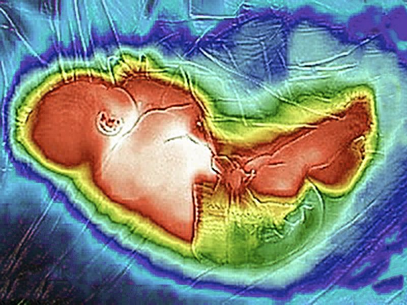 © ROGER GRASAS - Thermographic image of our newborn daughter sleeping