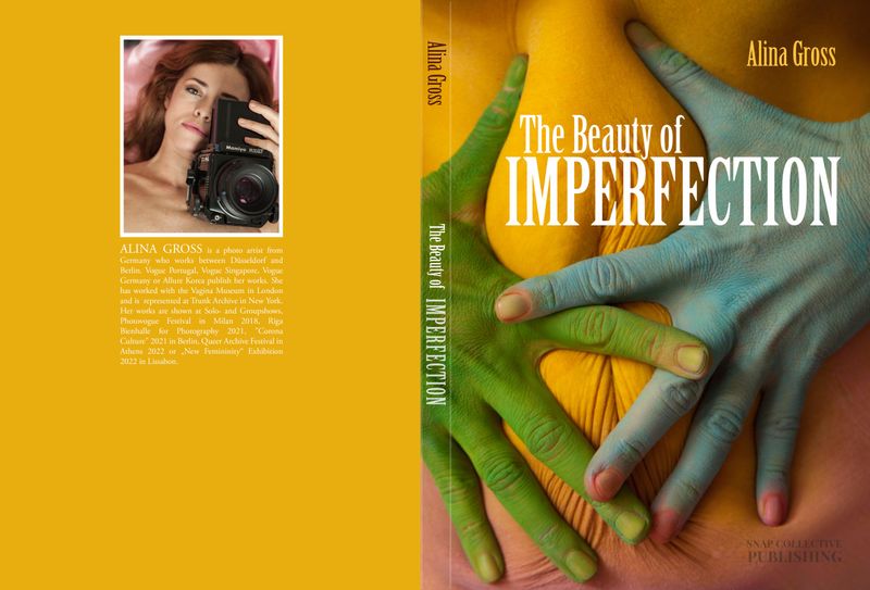 © Alina Gross - Image from the The Beauty of Imperfection photography project