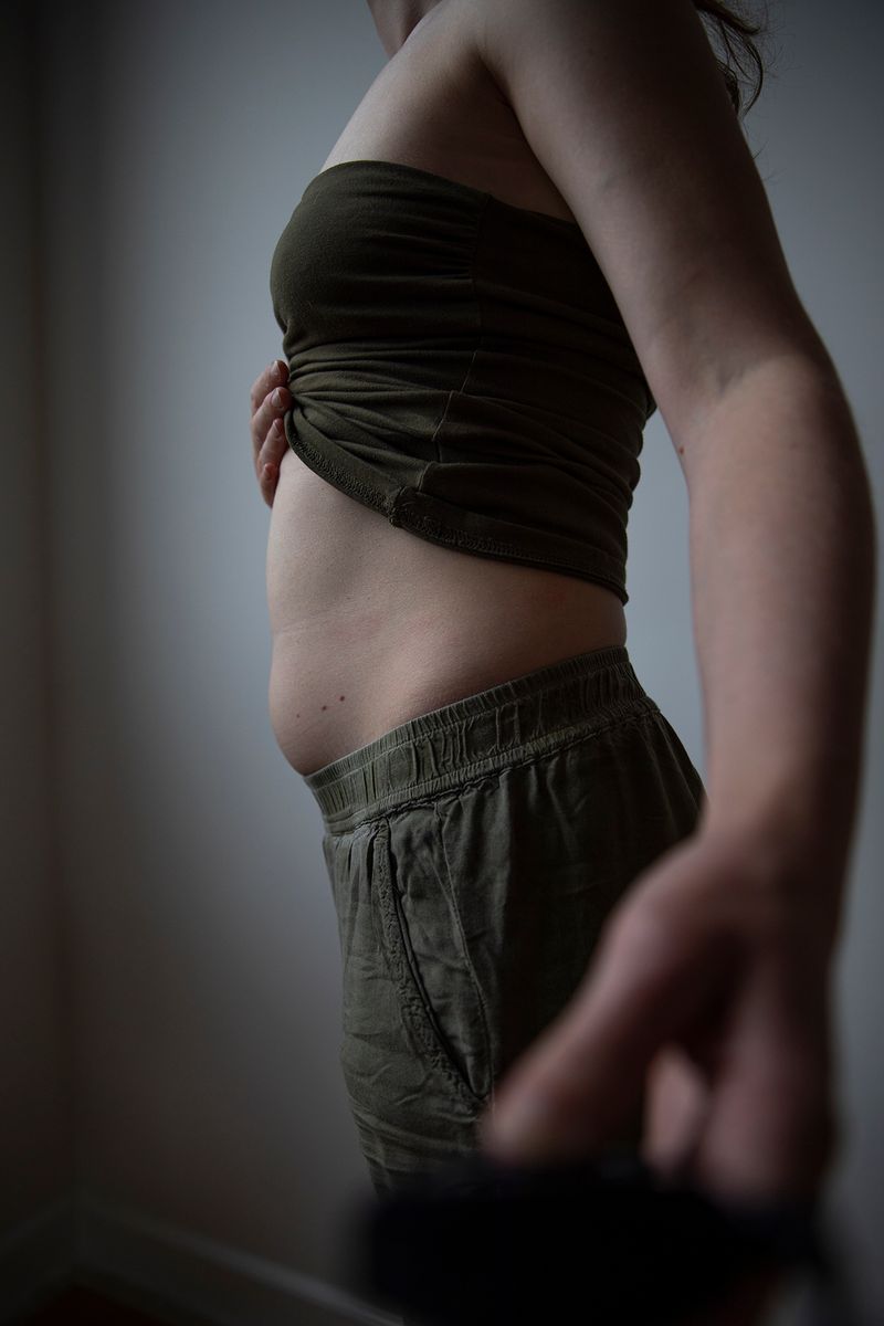 © Anne Nobels - Image from the Burning Lilies photography project