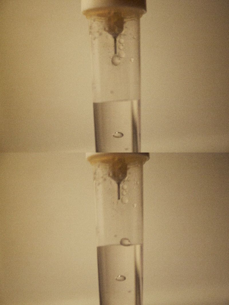 © Sayuri Ichida - The night felt much longer while staying in her hospital room.