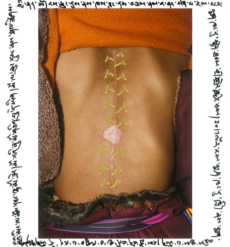 © jake homovich - Image from the Tibetan Country Doctor photography project