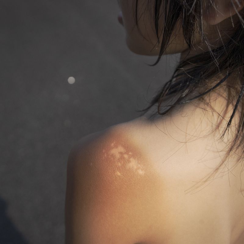 © Takako Kido - Sunburn