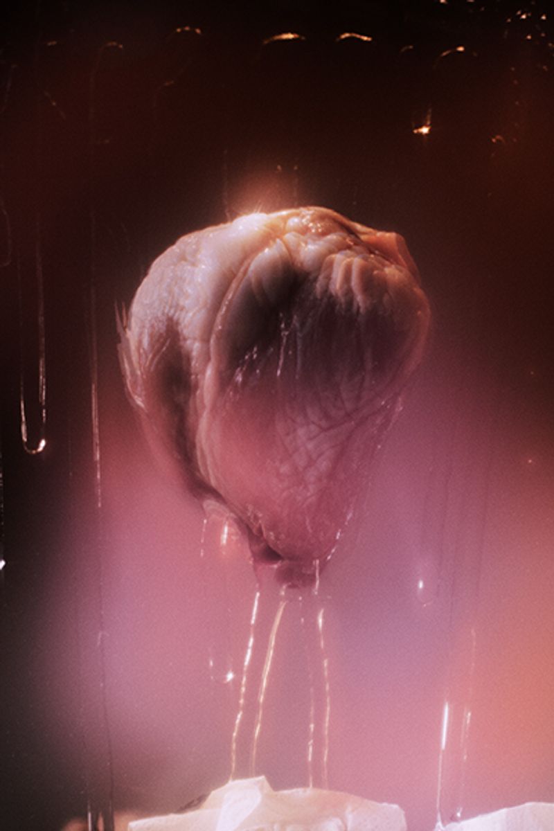 © Sasha Mongin - Image from the The Dying Man Who Would Not Die photography project