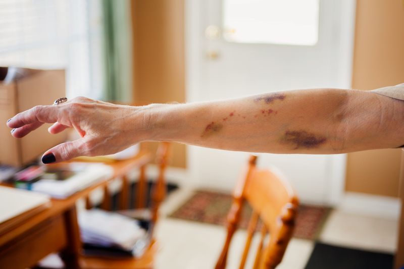 © Melissa Spitz - Intravenous Fluids, 2014