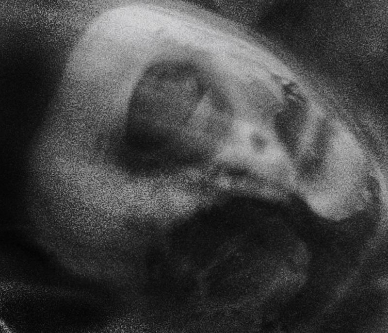 © Boris Eldagsen - Black Mirror 1a