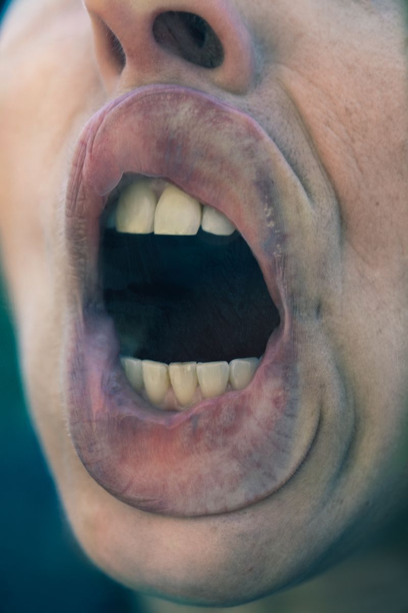 © Lisa Gervassi - Image from the Odontophilia photography project