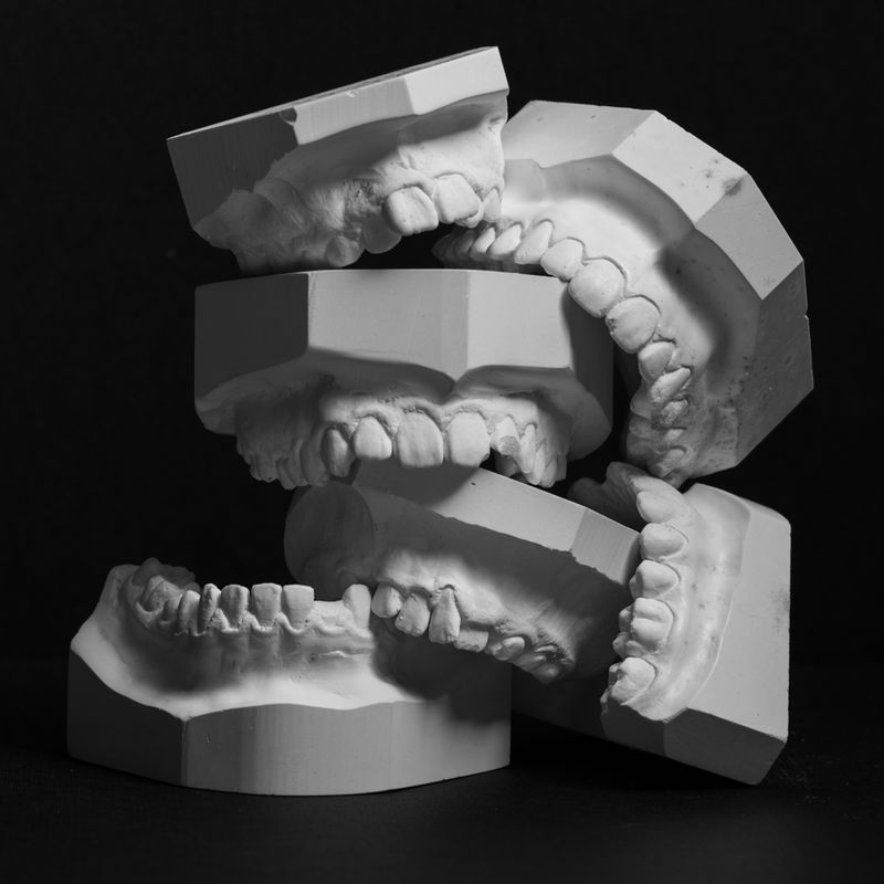 © Lisa Gervassi - Image from the Odontophilia photography project