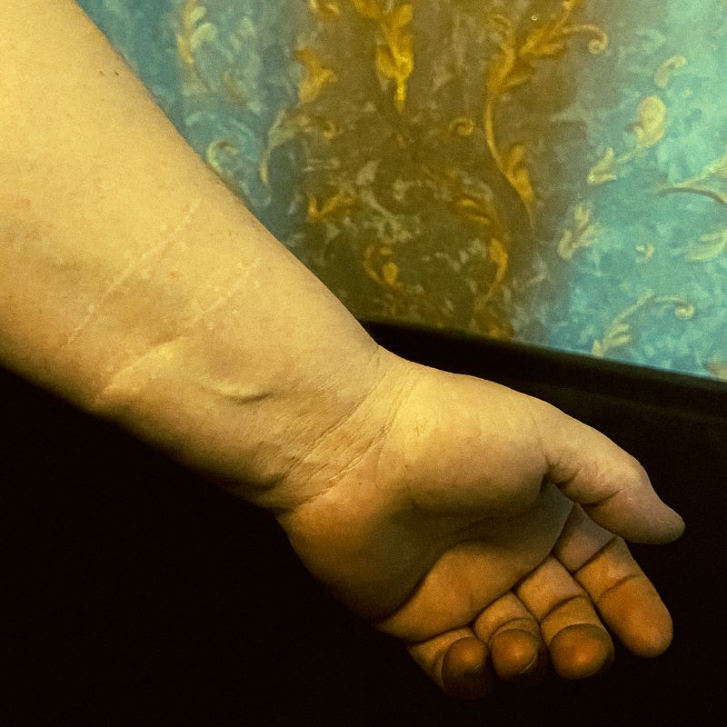 © Lali Binyatova - Image from the Dark diary photography project