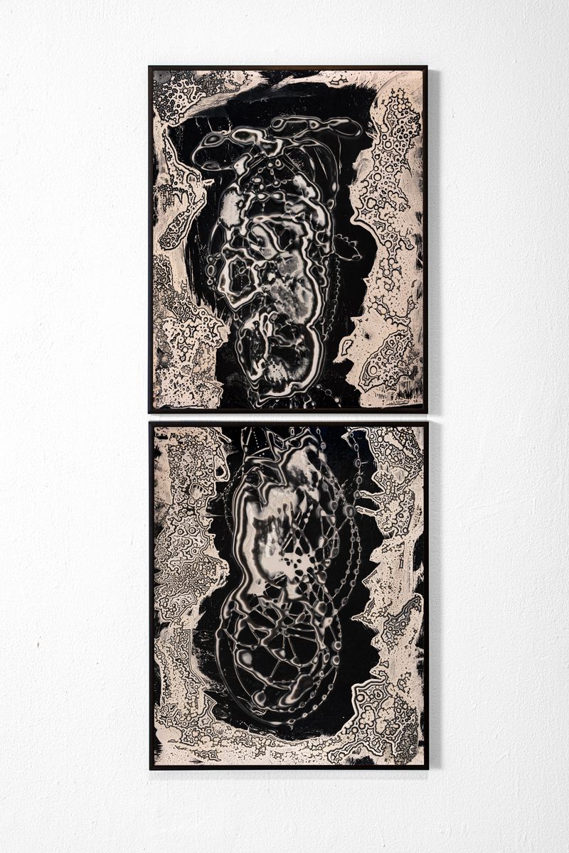 © Kei Ito - Image from the Burning Away: Under My Skin photography project
