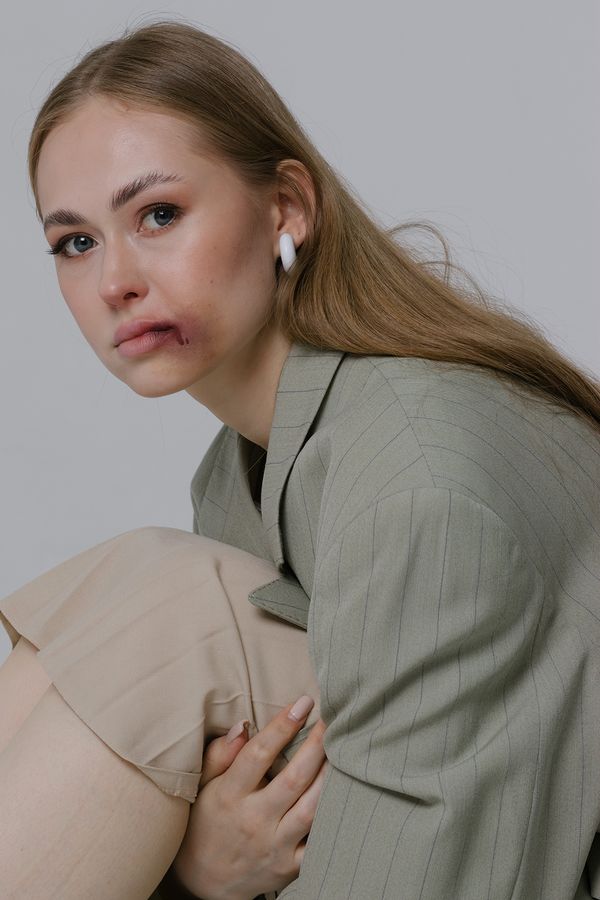 © Zhanar Kuzhakhmetova - Image from the Domestic violence in Kazakhstan photography project