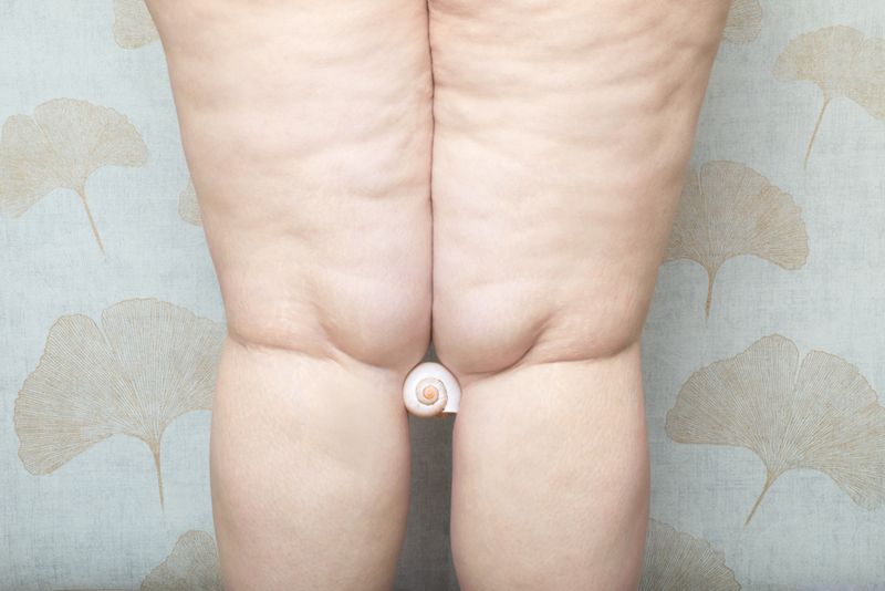 © Stefania Mattioli - Image from the Obesa photography project