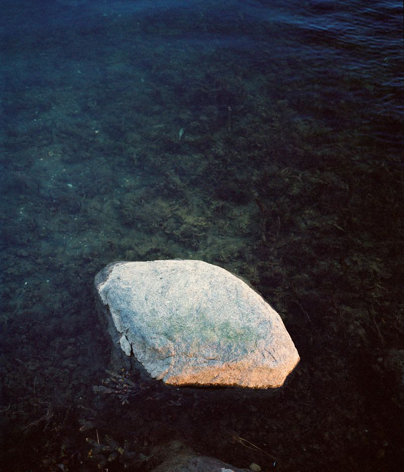 © Amelie Sachs - The mental stress in PCOS is enormously high for many patients and receives even less attention than the physical symptoms.
