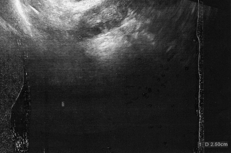 © Amelie Sachs - Image from the Forget Me Not photography project