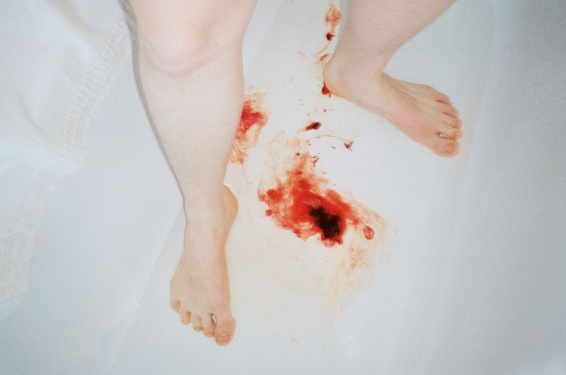 © Amelie Sachs - Image from the Forget Me Not photography project