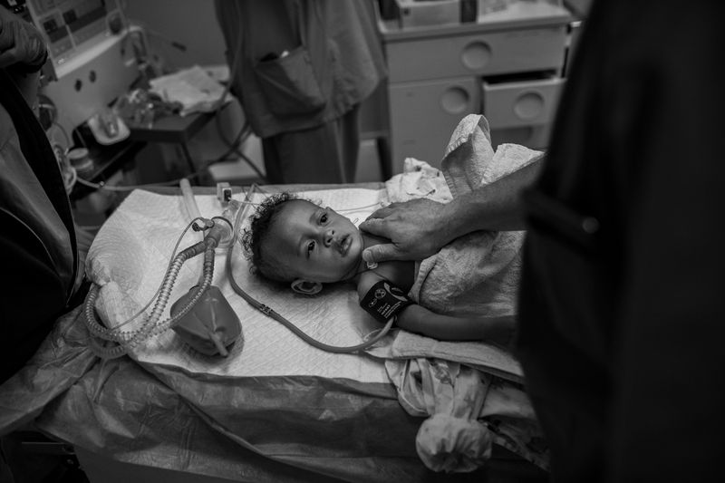 © Carlo Perazzolo - Child is ready to under go surgical heart operation.