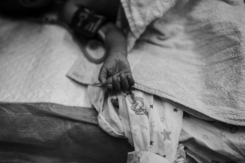 © Carlo Perazzolo - Child is ready to under go surgical heart operation.