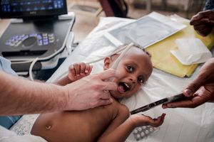 Heart diseases surgery in Eritrea