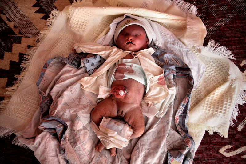 © Olmo Calvo - Image from the Aymara´s births in Patacamaya photography project