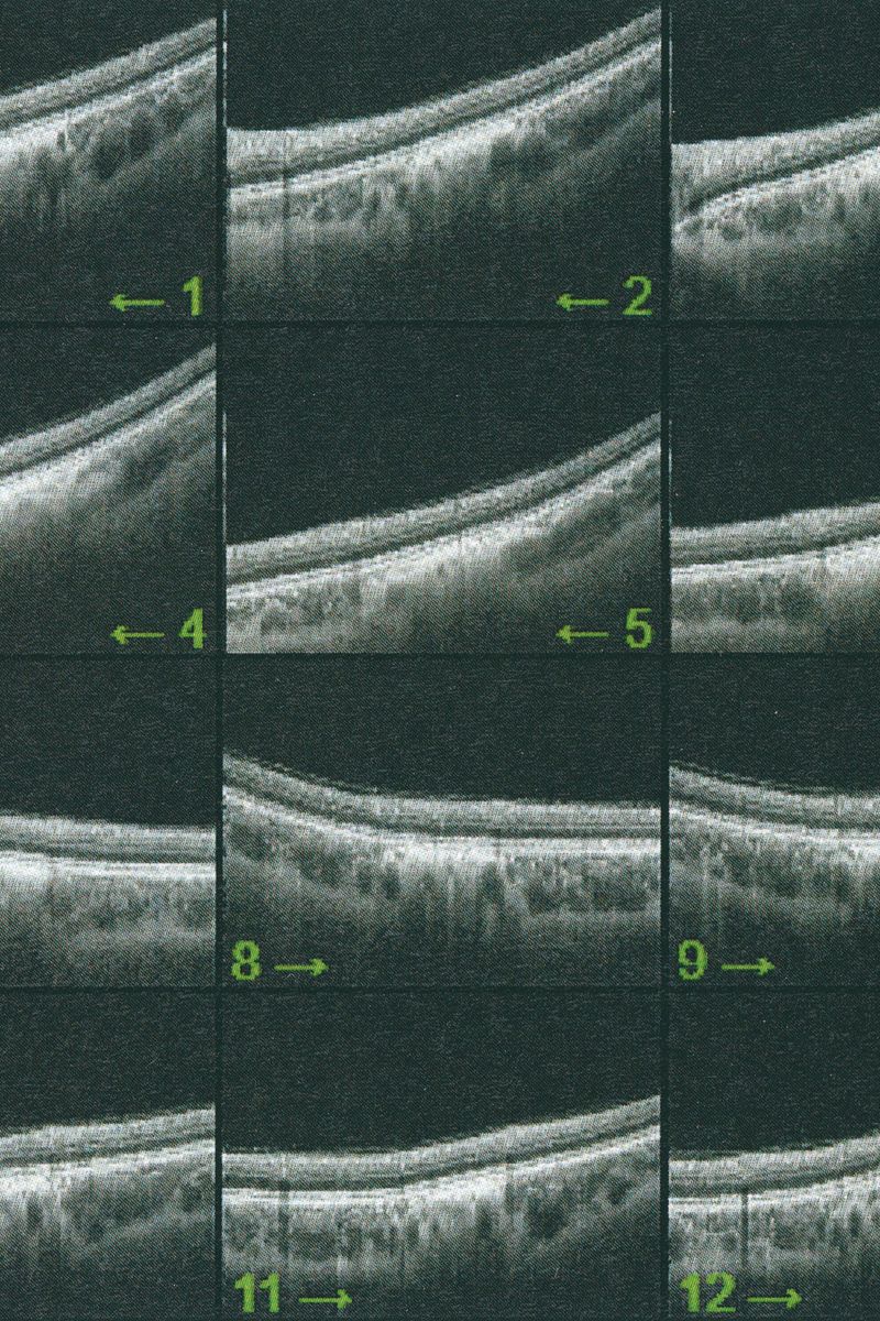 © Eugenio Pancaldi - Image from the Collirio photography project