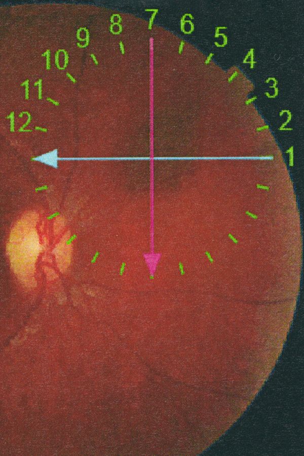 © Eugenio Pancaldi - Image from the Collirio photography project